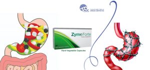 Symptoms of Indigestion and Irritable Bowel Syndrome (IBS)