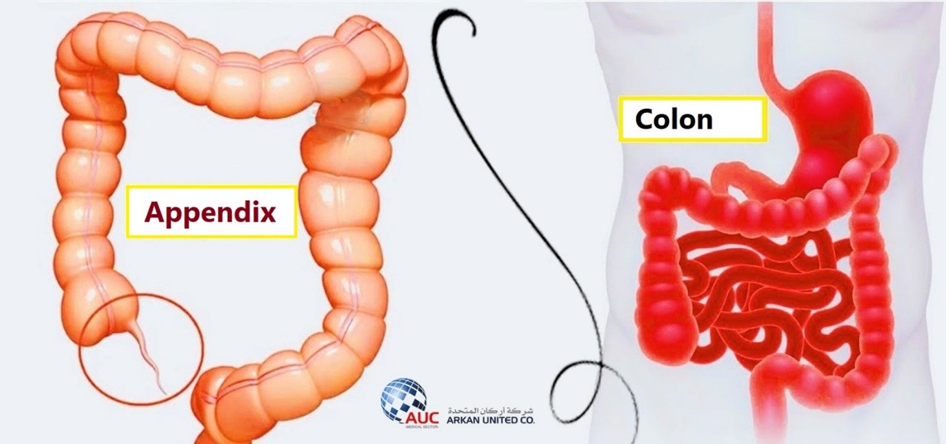 Differences Between Appendicitis and IBS Symptoms